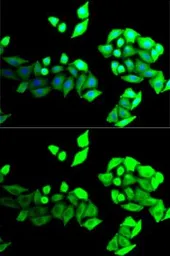Anti-Bestrophin 1 antibody used in Immunocytochemistry/ Immunofluorescence (ICC/IF). GTX65886