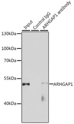 Anti-ARHGAP1 antibody used in Immunoprecipitation (IP). GTX65887