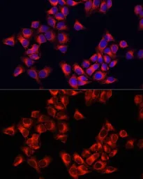 Anti-ARHGAP1 antibody used in Immunocytochemistry/ Immunofluorescence (ICC/IF). GTX65887