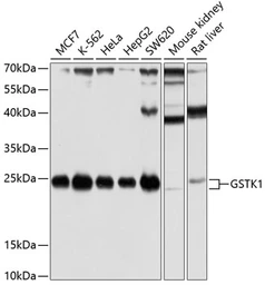 Anti-Glutathione S-transferase kappa 1 antibody used in Western Blot (WB). GTX65889