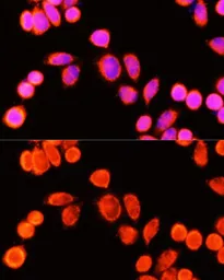 Anti-Glutathione S-transferase kappa 1 antibody used in Immunocytochemistry/ Immunofluorescence (ICC/IF). GTX65889