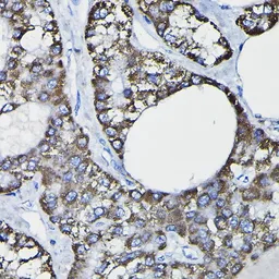 Anti-Glutathione S-transferase kappa 1 antibody used in IHC (Paraffin sections) (IHC-P). GTX65889