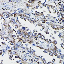 Anti-Glutathione S-transferase kappa 1 antibody used in IHC (Paraffin sections) (IHC-P). GTX65889