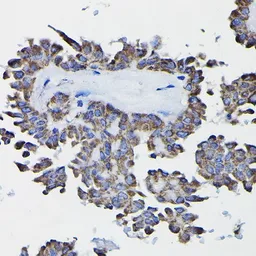 Anti-Glutathione S-transferase kappa 1 antibody used in IHC (Paraffin sections) (IHC-P). GTX65889