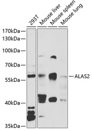 Anti-ALAS-E antibody used in Western Blot (WB). GTX65890