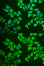 Anti-ALAS-E antibody used in Immunocytochemistry/ Immunofluorescence (ICC/IF). GTX65890