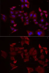 Anti-NPHP1 antibody used in Immunocytochemistry/ Immunofluorescence (ICC/IF). GTX65891