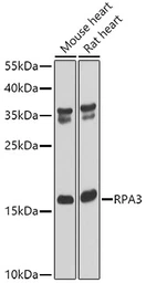 Anti-RPA14 antibody used in Western Blot (WB). GTX65893