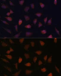 Anti-TREX1 antibody used in Immunocytochemistry/ Immunofluorescence (ICC/IF). GTX65894