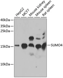 Anti-SUMO4 antibody used in Western Blot (WB). GTX65895