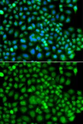 Anti-SUMO4 antibody used in Immunocytochemistry/ Immunofluorescence (ICC/IF). GTX65895