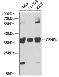 Anti-CENPK antibody used in Western Blot (WB). GTX65896