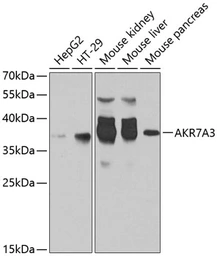 Anti-AKR7A3 antibody used in Western Blot (WB). GTX65900