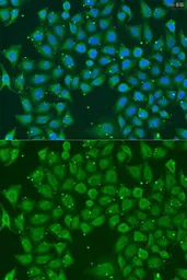 Anti-AKR7A3 antibody used in Immunocytochemistry/ Immunofluorescence (ICC/IF). GTX65900