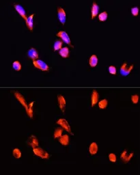 Anti-Annexin III antibody used in Immunocytochemistry/ Immunofluorescence (ICC/IF). GTX65903