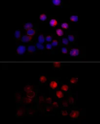 Anti-TOM1 antibody used in Immunocytochemistry/ Immunofluorescence (ICC/IF). GTX65905