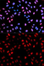 Anti-Raf1 (phospho Ser621) antibody used in Immunocytochemistry/ Immunofluorescence (ICC/IF). GTX65906