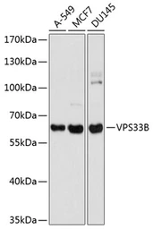 Anti-VPS33B antibody used in Western Blot (WB). GTX65908
