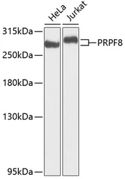 Anti-PRP8 antibody used in Western Blot (WB). GTX65909
