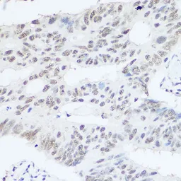 Anti-PRP8 antibody used in IHC (Paraffin sections) (IHC-P). GTX65909
