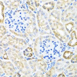 Anti-TIRAP antibody used in IHC (Paraffin sections) (IHC-P). GTX65910