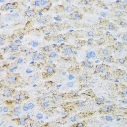 Anti-TIRAP antibody used in IHC (Paraffin sections) (IHC-P). GTX65910