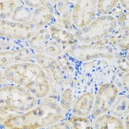 Anti-TIRAP antibody used in IHC (Paraffin sections) (IHC-P). GTX65910