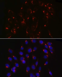 Anti-COPB2 antibody used in Immunocytochemistry/ Immunofluorescence (ICC/IF). GTX65917