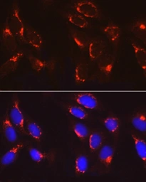 Anti-COPB2 antibody used in Immunocytochemistry/ Immunofluorescence (ICC/IF). GTX65917