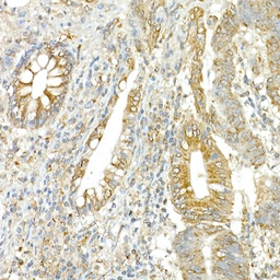 Anti-COPB2 antibody used in IHC (Paraffin sections) (IHC-P). GTX65917