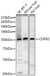 Anti-COPB2 antibody used in Western Blot (WB). GTX65917