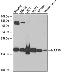Anti-NAT13 antibody used in Western Blot (WB). GTX65919