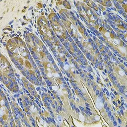 Anti-NAT13 antibody used in IHC (Paraffin sections) (IHC-P). GTX65919