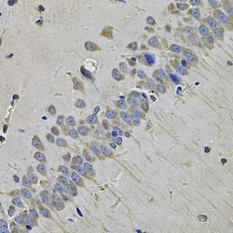 Anti-NAT13 antibody used in IHC (Paraffin sections) (IHC-P). GTX65919
