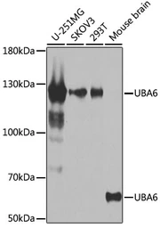 Anti-UBA6 antibody used in Western Blot (WB). GTX65920