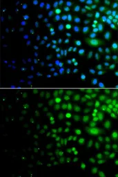 Anti-UBA6 antibody used in Immunocytochemistry/ Immunofluorescence (ICC/IF). GTX65920
