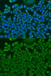 Anti-HS1BP3 antibody used in Immunocytochemistry/ Immunofluorescence (ICC/IF). GTX65921