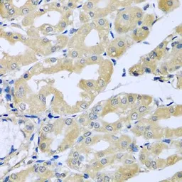Anti-HS1BP3 antibody used in IHC (Paraffin sections) (IHC-P). GTX65921