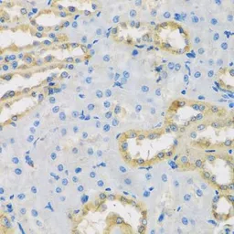 Anti-HS1BP3 antibody used in IHC (Paraffin sections) (IHC-P). GTX65921