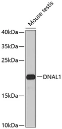 Anti-DNAL1 antibody used in Western Blot (WB). GTX65922