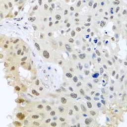 Anti-DNAL1 antibody used in IHC (Paraffin sections) (IHC-P). GTX65922