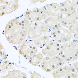 Anti-DNAL1 antibody used in IHC (Paraffin sections) (IHC-P). GTX65922