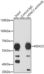 Anti-HDAC2 antibody used in Immunoprecipitation (IP). GTX65924