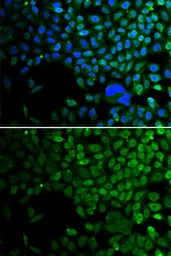 Anti-HDAC2 antibody used in Immunocytochemistry/ Immunofluorescence (ICC/IF). GTX65924