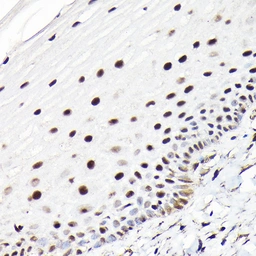 Anti-CTCF antibody used in IHC (Paraffin sections) (IHC-P). GTX65926