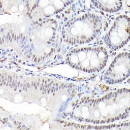 Anti-CTCF antibody used in IHC (Paraffin sections) (IHC-P). GTX65926