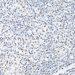 Anti-CTCF antibody used in IHC (Paraffin sections) (IHC-P). GTX65926