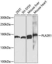 Anti-PLA2R1 antibody used in Western Blot (WB). GTX65929
