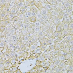 Anti-PLA2R1 antibody used in IHC (Paraffin sections) (IHC-P). GTX65929