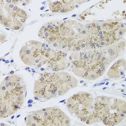 Anti-MTERFD3 antibody used in IHC (Paraffin sections) (IHC-P). GTX65932